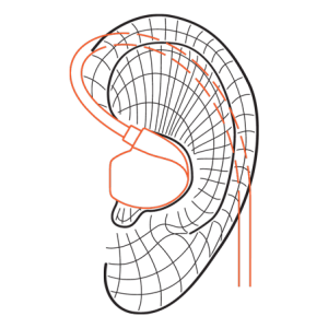 earhook-diagram